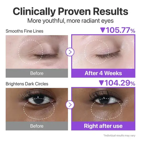 numbuzin-no.9-nad_-retinol-volumetox-eye-cream-04